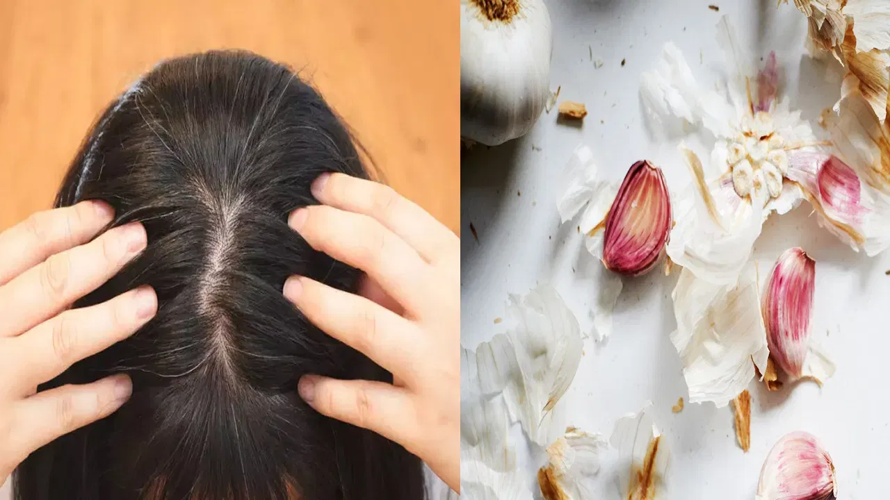 హెయిర్ ఫాల్ కంట్రోల్ చేయడానికి ఇప్పటికే ఎన్నో చిట్కాలు తెలుసుకున్నాం. జుట్టు రాలడాన్ని తగ్గించడంలో వెల్లుల్లి కూడా ఎంతో చక్కగా హెల్ప్ చేస్తుంది. వెల్లుల్లిలో ఉండే అల్లిసిన్ సమ్మేళనం జుట్టు రాలే సమస్యను తగ్గించి.. బలంగా ఉండేలా చేస్తుంది.
