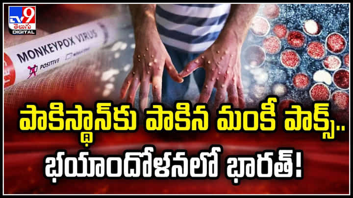 Monkeypox: పాకిస్థాన్కు పాకిన మంకీ పాక్స్.. భయాందోళనలో భారత్.! Monkeypox: పాకిస్థాన్కు పాకిన మంకీ పాక్స్.. భయాందోళనలో భారత్.!