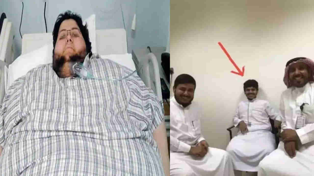 Worlds Heaviest Man: అద్భుతం కాదు అంతకుమించి.. 6 నెలల్లో 540 కిలోల నుంచి 60 కిలోలకు బరువు తగ్గిన భారీకాయుడు..!