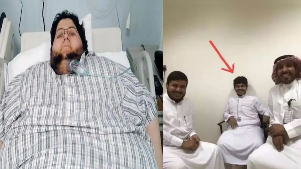 World's Heaviest Man: అద్భుతం కాదు అంతకుమించి.. 6 నెలల్లో 540 కిలోల నుంచి 60 కిలోలకు బరువు తగ్గిన భారీకాయుడు..!