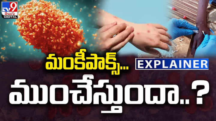 Explainer: మంకీపాక్స్.. ముంచేస్తుందా ?? దీని లక్షణాలు ఏంటంటే ?? Explainer: మంకీపాక్స్.. ముంచేస్తుందా ?? దీని లక్షణాలు ఏంటంటే ??