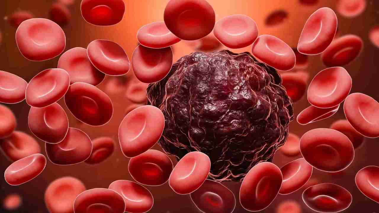 Blood Cancer: ఈ లక్షణాలు కనిపించాయంటే బ్లడ్ క్యాన్సరే..