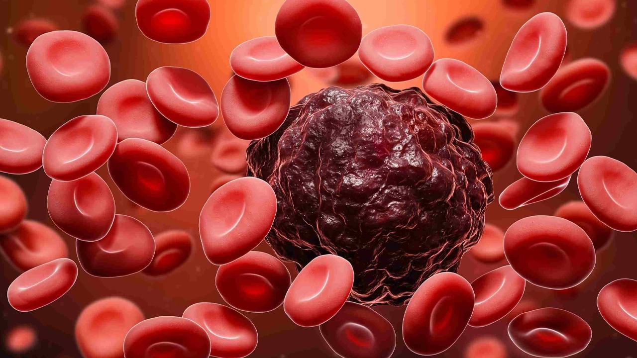 Blood Cancer: ఈ లక్షణాలు కనిపించాయంటే బ్లడ్ క్యాన్సరే..