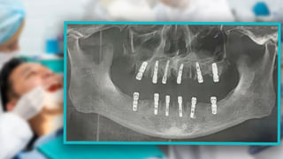 Viral News: రెండో పెళ్లి కోసం వరుడు కావాలి.. రూ. 30 లక్షల జీతం, 3BHK, ఇల్లు, అత్తమామలు ఉండకూడదు.. మరిన్ని కండిషన్స్ అప్లై..