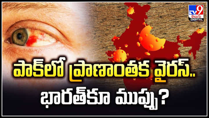 Eye Bleeding: పాక్లో ప్రాణాంతక వైరస్.. భారత్కూ ముప్పు.? కళ్ల నుండి రక్తం దార. Eye Bleeding: పాక్లో ప్రాణాంతక వైరస్.. భారత్కూ ముప్పు.? కళ్ల నుండి రక్తం దార.