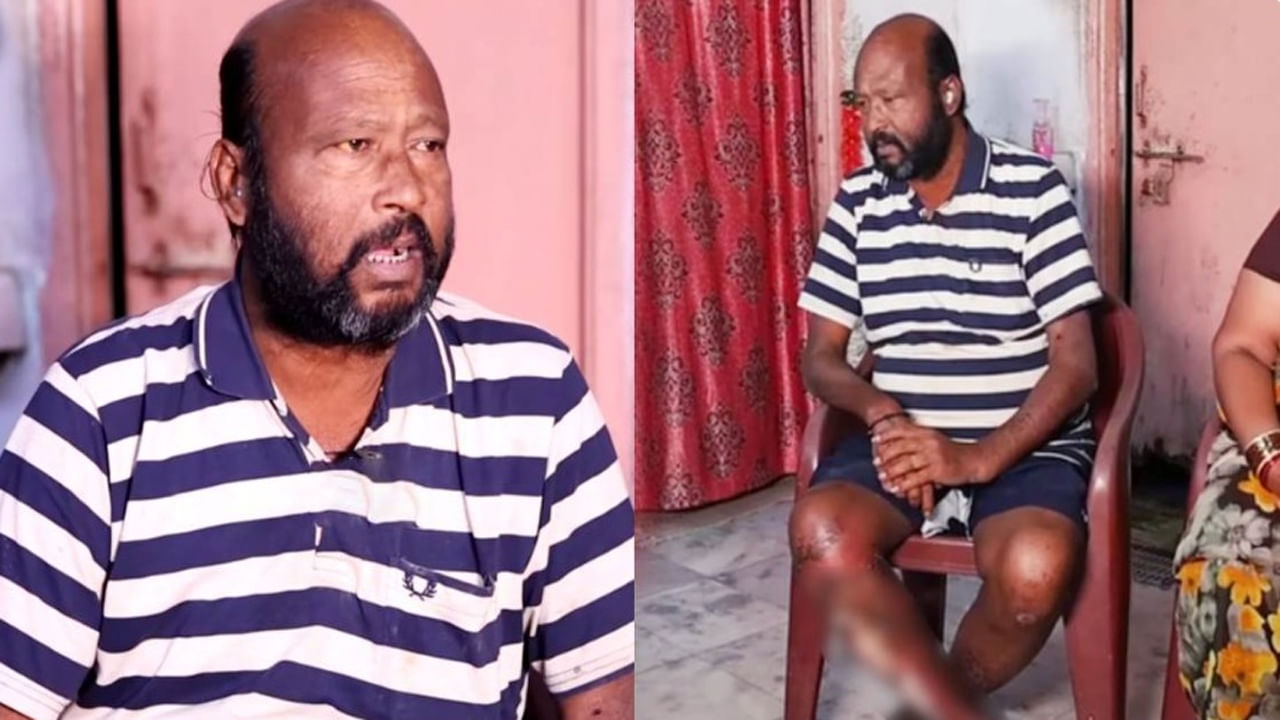 Fish Venkat: రెండు కిడ్నీలు చెడిపోయి దీన స్థితిలో నటుడు ఫిష్ వెంకట్.. సాయం కోసం ఎదురుచూపులు
