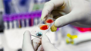 Health: గోరు వెచ్చని నీటిలో పసుపు కలుపుకొని తాగండి.. మార్పు మాములుగా ఉండదు