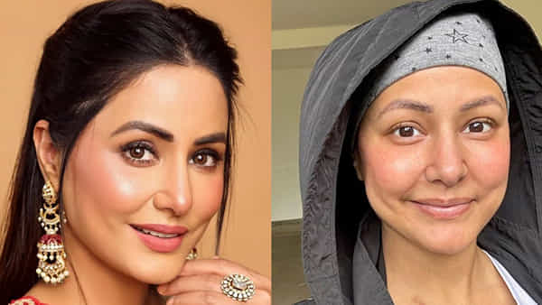 Hina Khan: ఇప్పటికే క్యాన్సర్తో పోరాటం.. మరో భయంకరమైన వ్యాధి బారిన ప్రముఖ నటి.. సాయం చేయాలని వేడుకోలు