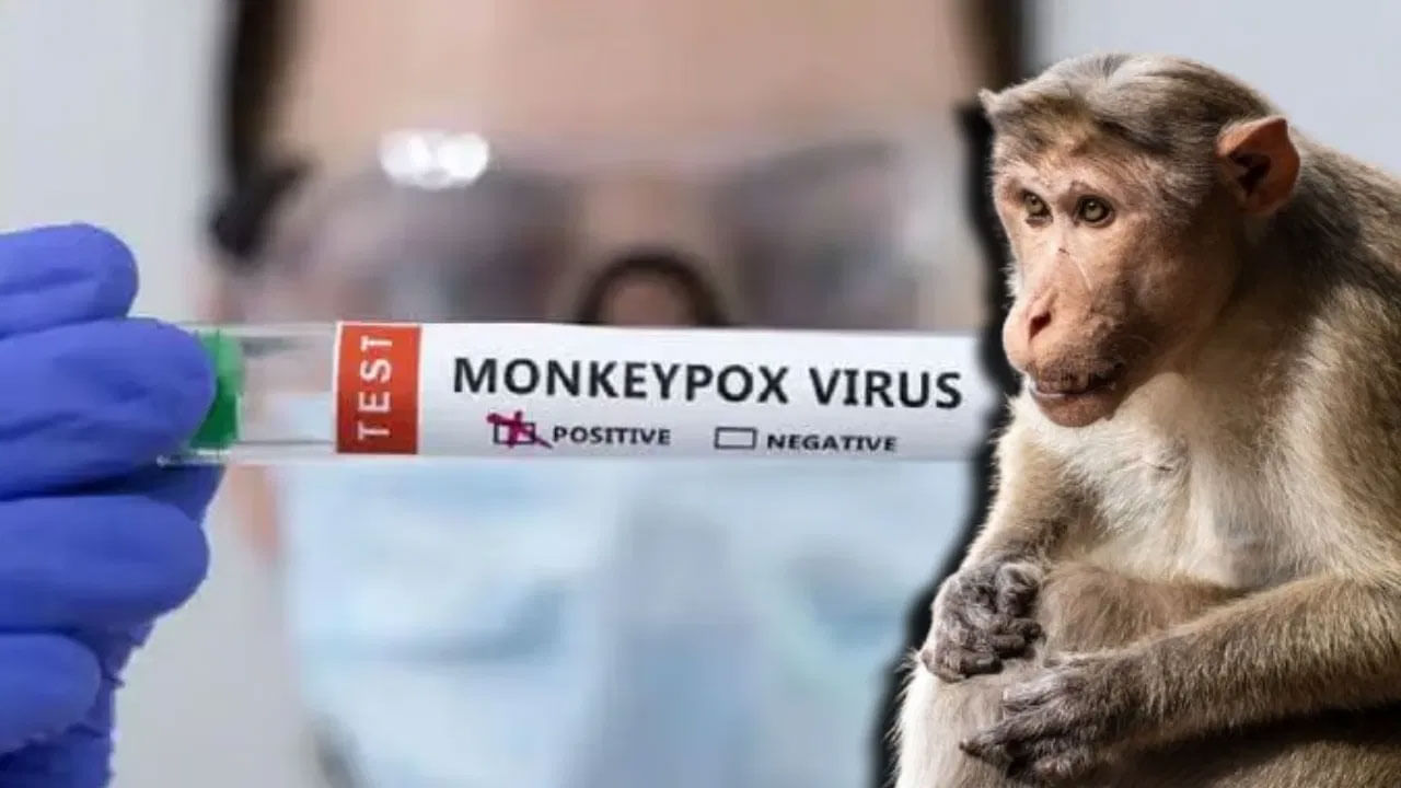 Monkeypox