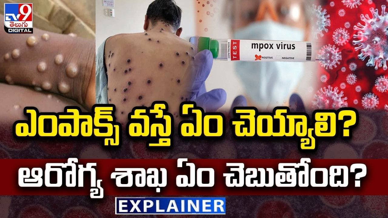 ఎంపాక్స్ వస్తే ఏం చెయ్యాలి ?? ఆరోగ్య శాఖ ఏం చెబుతోంది ??