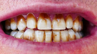 Sugar in Milk: నవజాత శిశివులకు పాలల్లో పంచదార వేసి ఇస్తున్నారా.. ఎన్ని వ్యాధులకు వెల్కం చెబుతున్నారో తెలుసా..