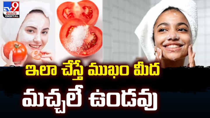 ఇలా చేస్తే ముఖం మీద మచ్చలే ఉండవు ఇలా చేస్తే ముఖం మీద మచ్చలే ఉండవు
