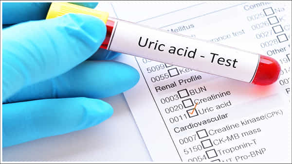 Uric Acid Test: యూరిక్ యాసిడ్ను గుర్తించడం ఎలా? ఇలా ఇంట్లోనే ఉండి పరీక్షించుకోండి!