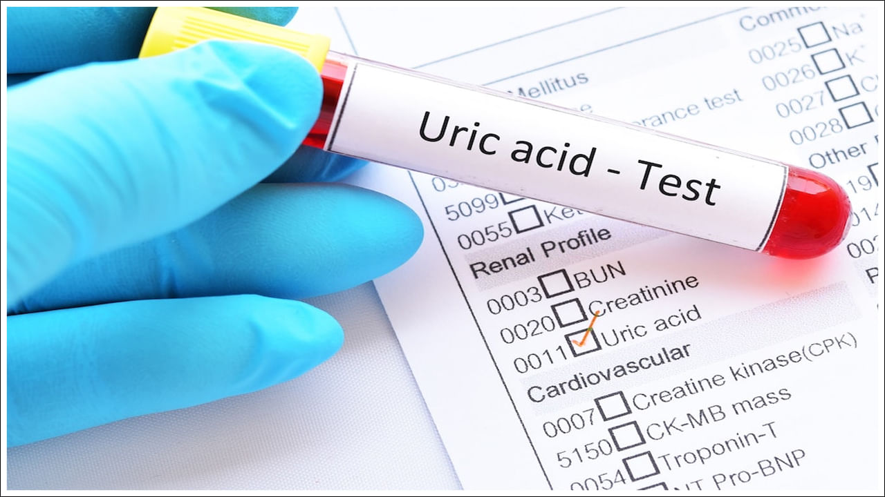 Uric Acid Test: యూరిక్ యాసిడ్‌ను గుర్తించడం ఎలా? ఇలా ఇంట్లోనే ఉండి పరీక్షించుకోండి!