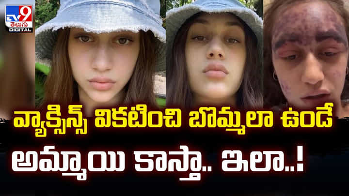 వ్యాక్సిన్స్ వికటించి బొమ్మలా ఉండే అమ్మాయి కాస్తా.. ఇలా !! వ్యాక్సిన్స్ వికటించి బొమ్మలా ఉండే అమ్మాయి కాస్తా.. ఇలా !!