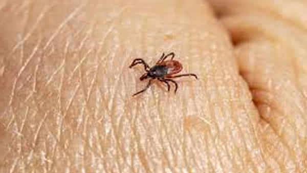 Wetland virus: కరోనా తర్వాత చైనాలో వెలుగులోకి కొత్త వైరస్.. మెదడుపై తీవ్ర ప్రభావం చూపే వెట్ల్యాండ్ వైరస్ లక్షణాలు ఏమిటంటే