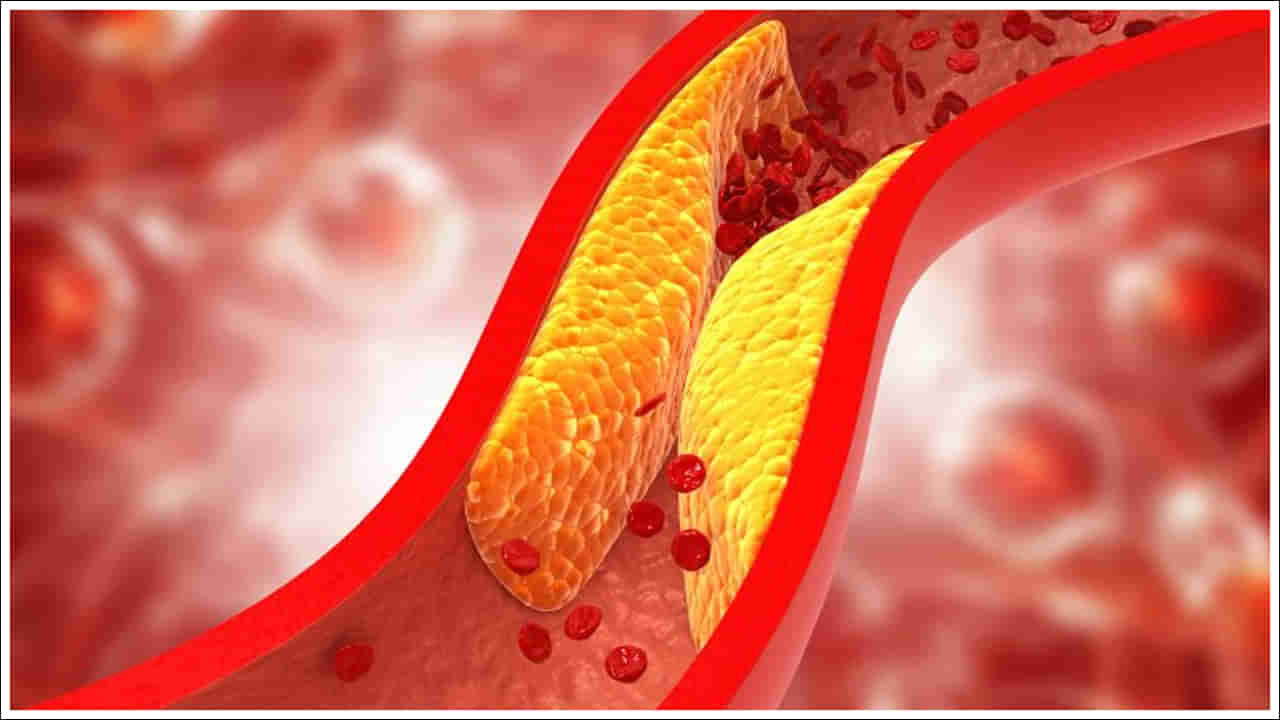 Cholesterol: చలికాలంలో శరీరంలో కొలెస్ట్రాల్‌ను పెంచే ఆహారాలు ఏంటో తెలుసా?