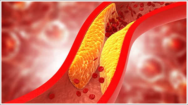 Cholesterol: చలికాలంలో శరీరంలో కొలెస్ట్రాల్ను పెంచే ఆహారాలు ఏంటో తెలుసా?