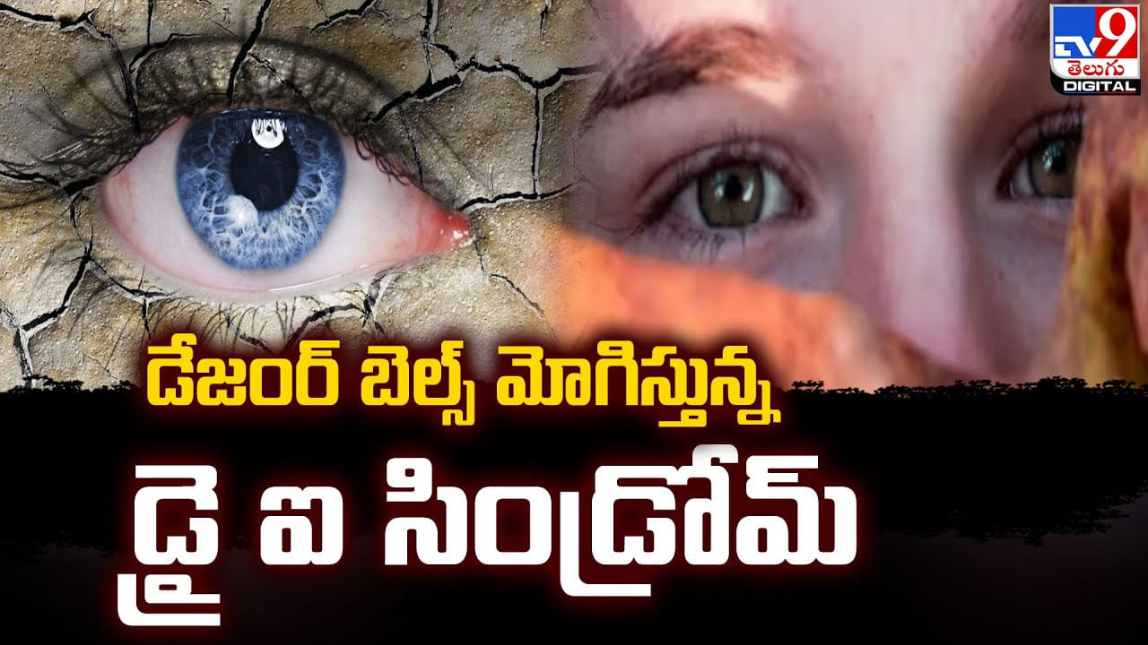 డేజంర్‌ బెల్స్ మోగిస్తున్న డ్రై ఐ సిండ్రోమ్