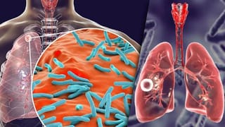 Himachal Pradesh: కాలుష్యం తగ్గించే దిశగా హిమాచల్ అడుగులు.. ఆర్టీసీకి మరో 327 ఒలెక్ట్రా బస్సులు