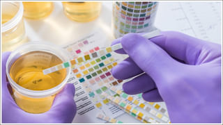 Foods To Purify Blood: రక్తాన్ని సహజంగా శుద్ధి చేసే ఆహారాలు.. ఆహారంలో తప్పక చేర్చుకోండి