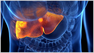 Custard Apple: తియ్యగా ఉందని తెగ తింటున్నారా.? ముందు ఈ విషయాలు తెలుసుకోండి..