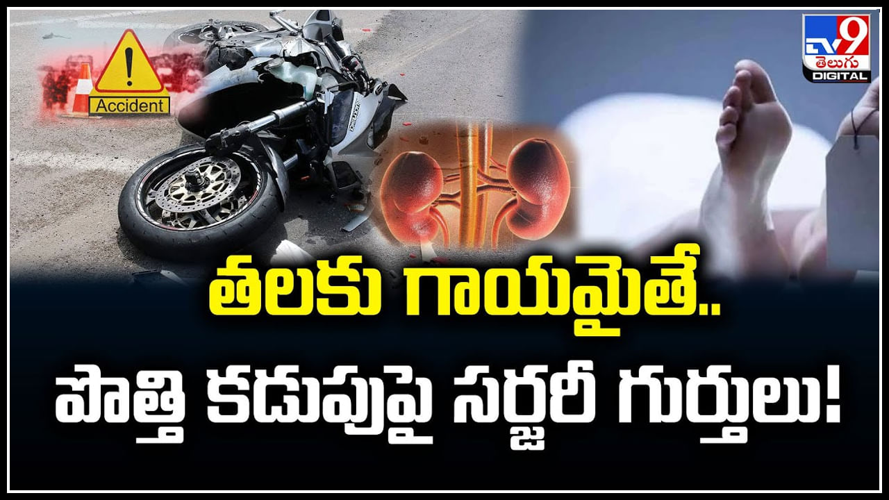 Viral: ఓర్నీ.. తలకు గాయమైతే.. పొత్తి కడుపుపై సర్జరీ గుర్తులు.! వీడియో..