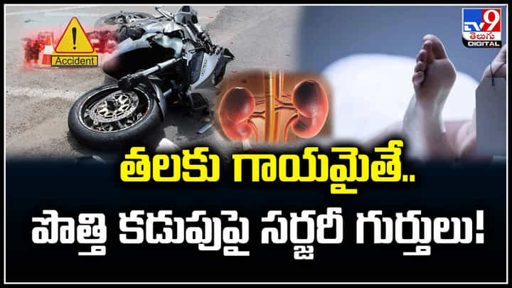 Viral: ఓర్నీ.. తలకు గాయమైతే.. పొత్తి కడుపుపై సర్జరీ గుర్తులు.! వీడియో.. Viral: ఓర్నీ.. తలకు గాయమైతే.. పొత్తి కడుపుపై సర్జరీ గుర్తులు.! వీడియో..