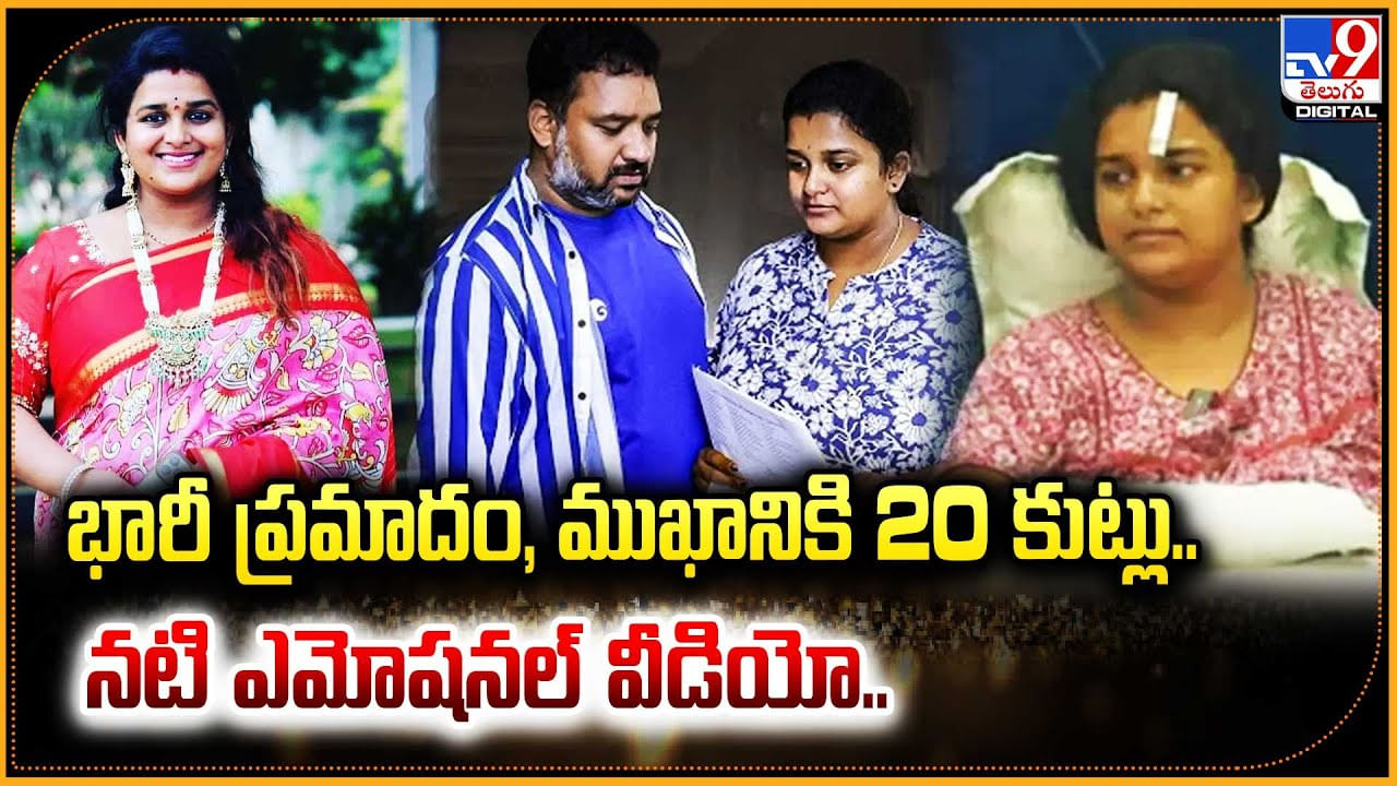 Srivani: భారీ ప్రమాదం, ముఖానికి 20 కుట్లు.. నటి ఎమోషనల్ వీడియో.!