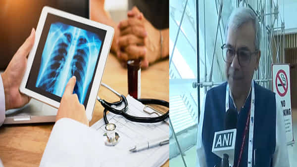 TB Disease: TB రోగులకు శుభవార్త.. కొత్త ఎక్స్రే పరికరం సృష్టి.. ఇంటి దగ్గరే పరీక్షించుకునే అవకాశం