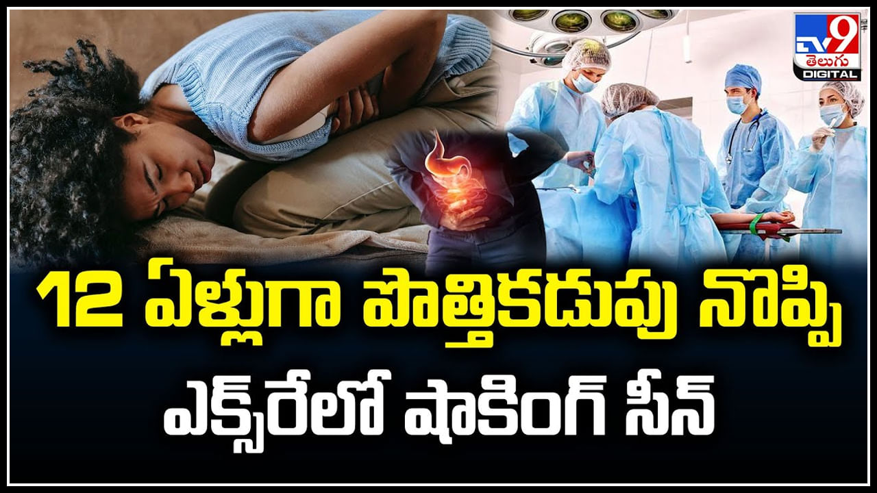 Watch: 12 ఏళ్లుగా పొత్తికడుపు నొప్పి.. ఎక్స్‌రేలో షాకింగ్‌ సీన్‌.! వీడియో..