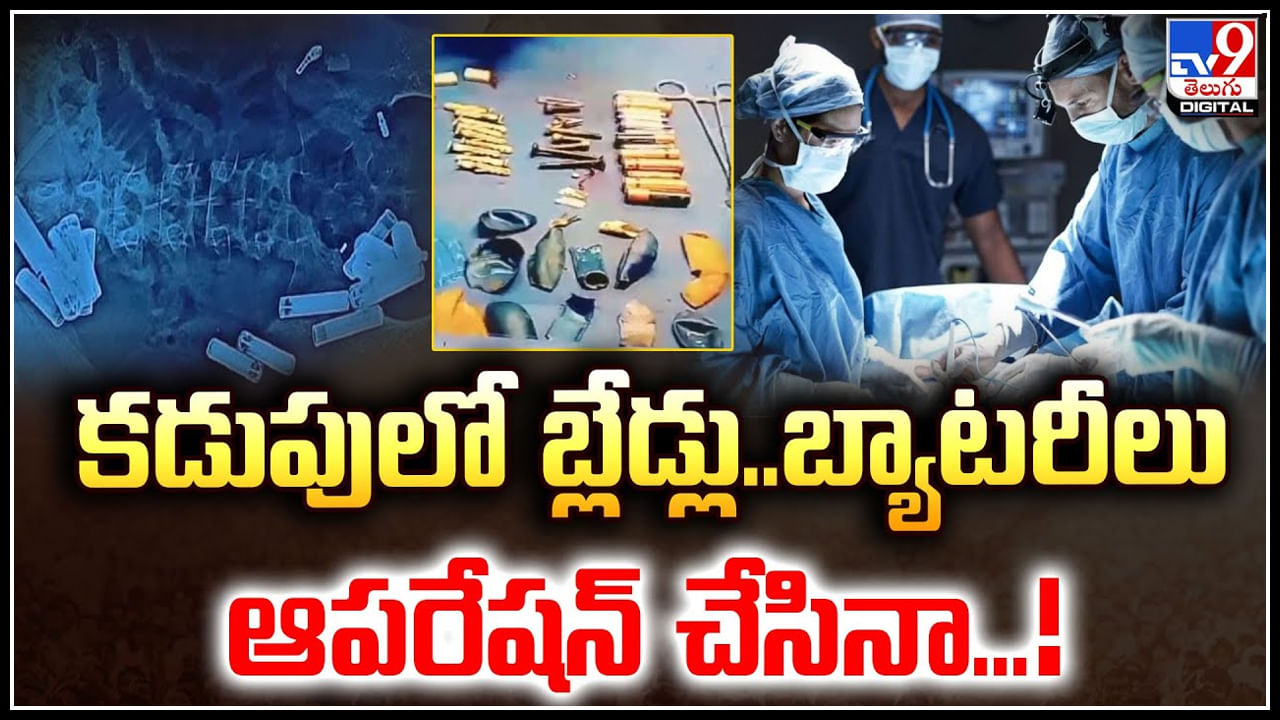 Watch: కడుపులో బ్లేడ్లు.. బ్యాటరీలు ఆపరేషన్ చేసినా దక్కని బాలుడి ప్రాణాలు.!