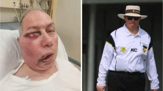 IPL 2025: ఆర్సీబీ కెప్టెన్‌గా ఆ ప్లేయర్ బెస్ట్.. టీమిండియా మాజీ క్రికెటర్ సలహా..