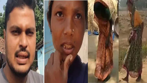 Strange disease: ఆ గ్రామంలో 30 ఏళ్లుగా వింత వ్యాధి.. చిన్న వయసులోనే వంగి పోయే శరీరం.. పట్టించుకోని పాలకులు