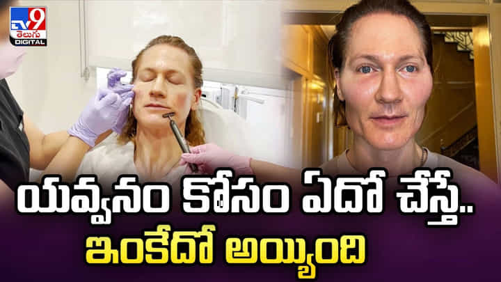 యవ్వనం కోసం ఏదో చేస్తే.. ఇంకేదో అయ్యింది యవ్వనం కోసం ఏదో చేస్తే.. ఇంకేదో అయ్యింది