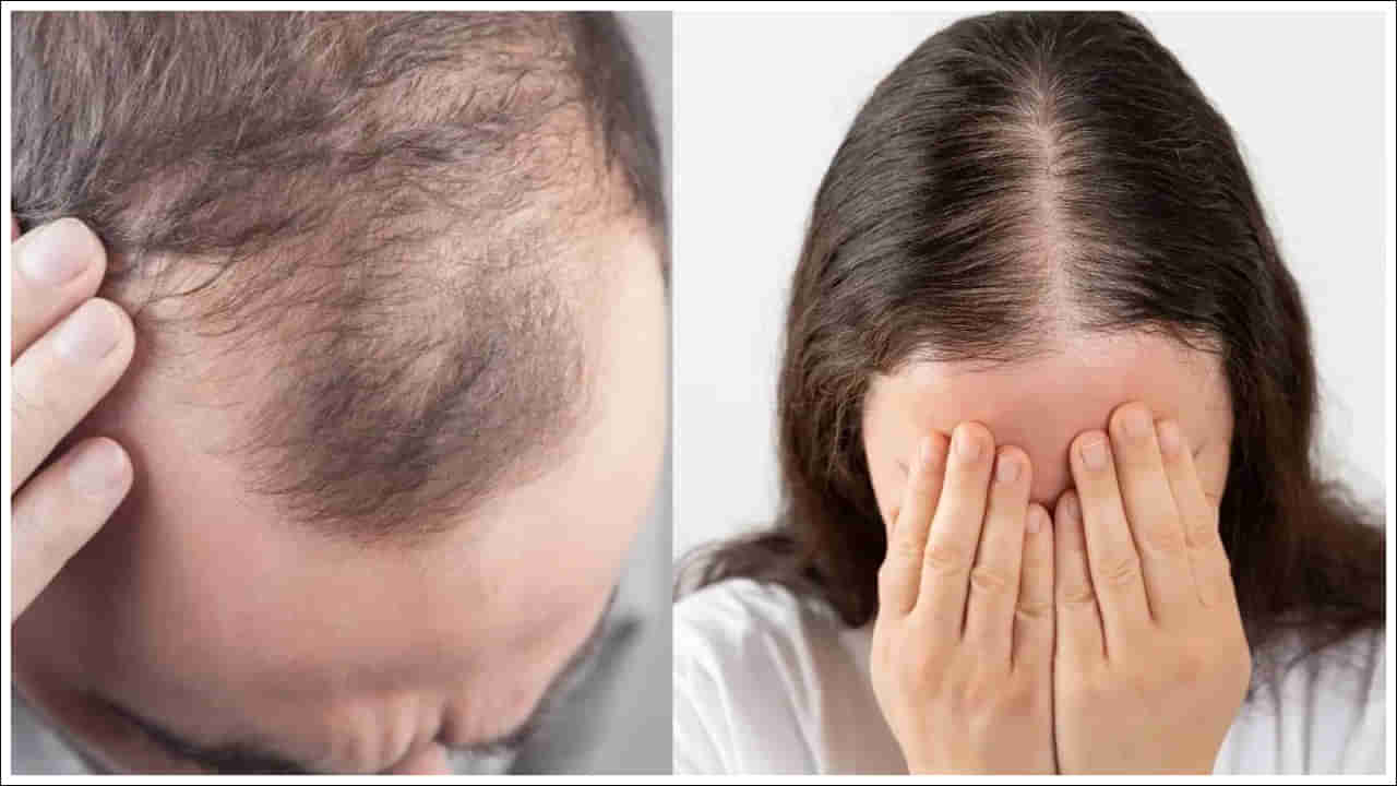 Hair Care Tips: చిన్న వయస్సులోనే జుట్టు రాలుతుందా..? ఈ మూడు ప్రధాన కారణాలు!