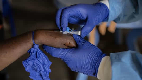 Monkeypox : కాంగోకి బిగ్ రిలీఫ్.. స్థిరంగా Mpox కొత్త వేరియంట్.. బురుండి, ఉగాండాలో వేగంగా వ్యాప్తి..