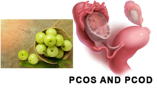 Eye Care: ఈ అలవాట్లతో కళ్ల సమస్యలే రావు.. ఆరోగ్యంగా ఉంటాయి..