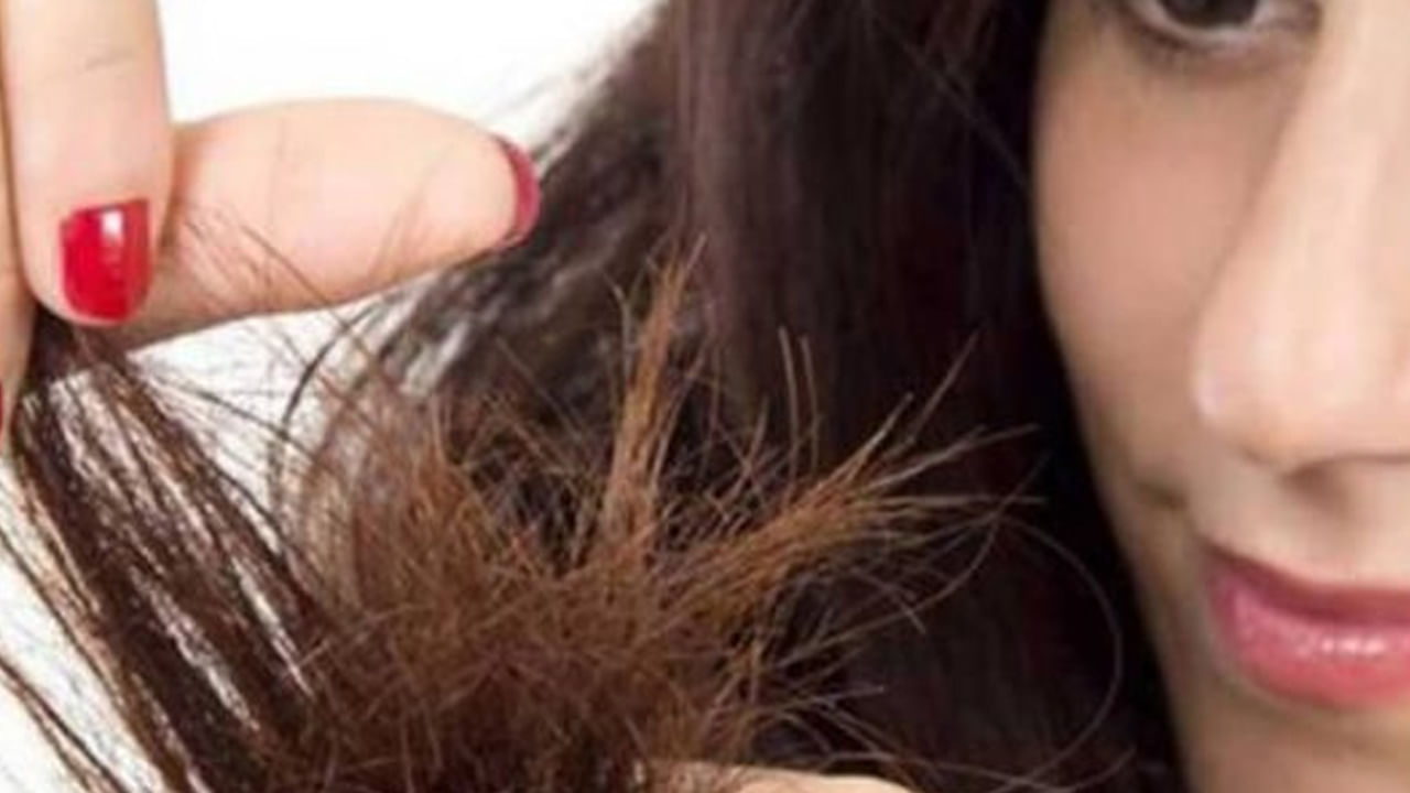 కొబ్బరి నూనె చిట్లిన జుట్టును చక్కగా నయం చేస్తుంది. కొబ్బరి నూనెను జుట్టుకు అప్లై చేయడం వల్ల జుట్టు రిపేర్ అవుతుంది. దృఢంగా ఉంటుంది. కొబ్బరి నూనెను కొద్దిగా వేడి చేసి జుట్టుకు పట్టించి 15 నిమిషాల పాటు మసాజ్ చేయాలి. దాదాపు రెండు గంటల తర్వాత షాంపూతో తలస్నానం చేస్తే సరి.