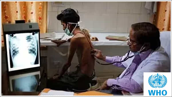 TB Treatment: చాప కింద నీరులా టీబీ కేసులు.. దేశంలో అత్యధికం.. WHO రిపోర్ట్లో కీలక విషయాలు