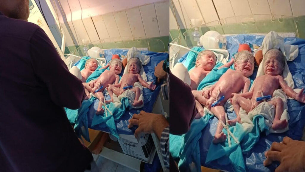 Woman Gave Birth To Triplet