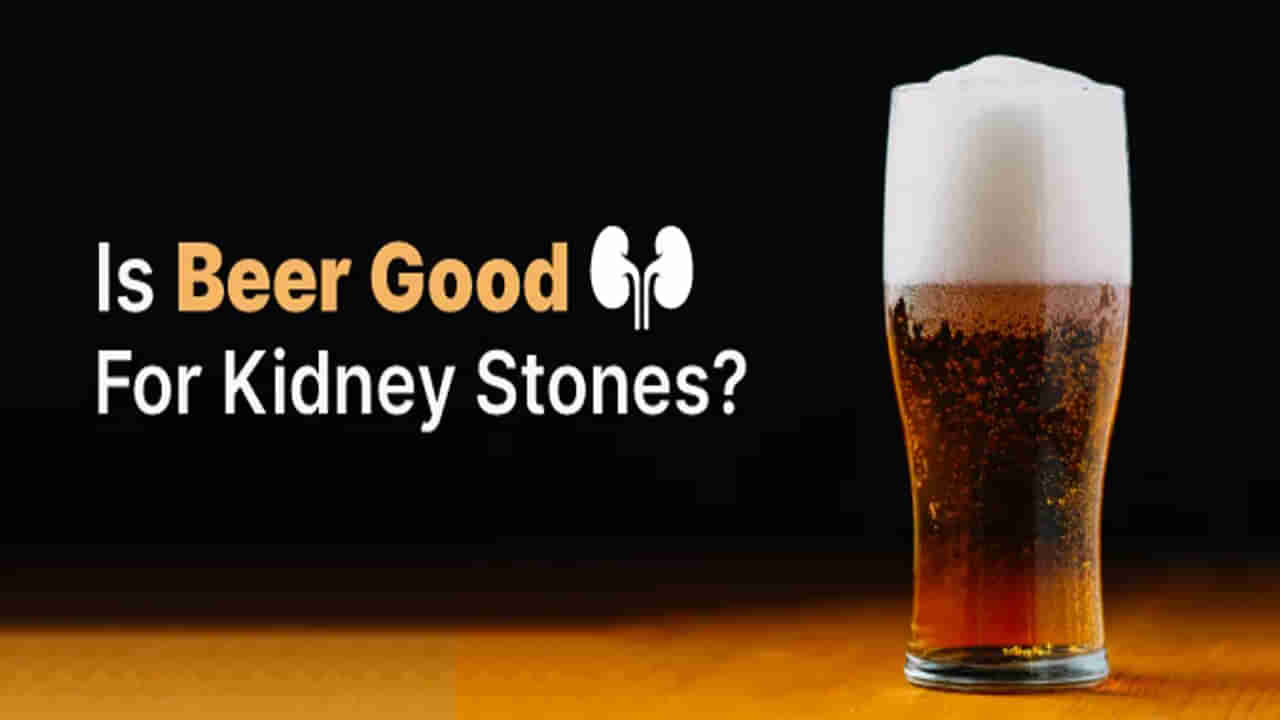 Beer for Kidney Stones: బీరు తాగితే కిడ్నీల్లో రాళ్లు కరుగుతాయా? ఇందులో నిజమెంత..