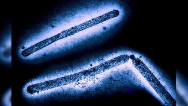 Bird Flu: అమెరికాలో తొలి బర్డ్ ఫ్లూ మరణం.. కలకలం రేపుతోన్న వైరస్