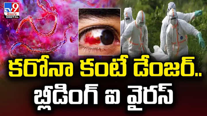 Bleeding Eye: కరోనా కంటే డేంజర్.. బ్లీడింగ్ ఐ వైరస్ !! Bleeding Eye: కరోనా కంటే డేంజర్.. బ్లీడింగ్ ఐ వైరస్ !!