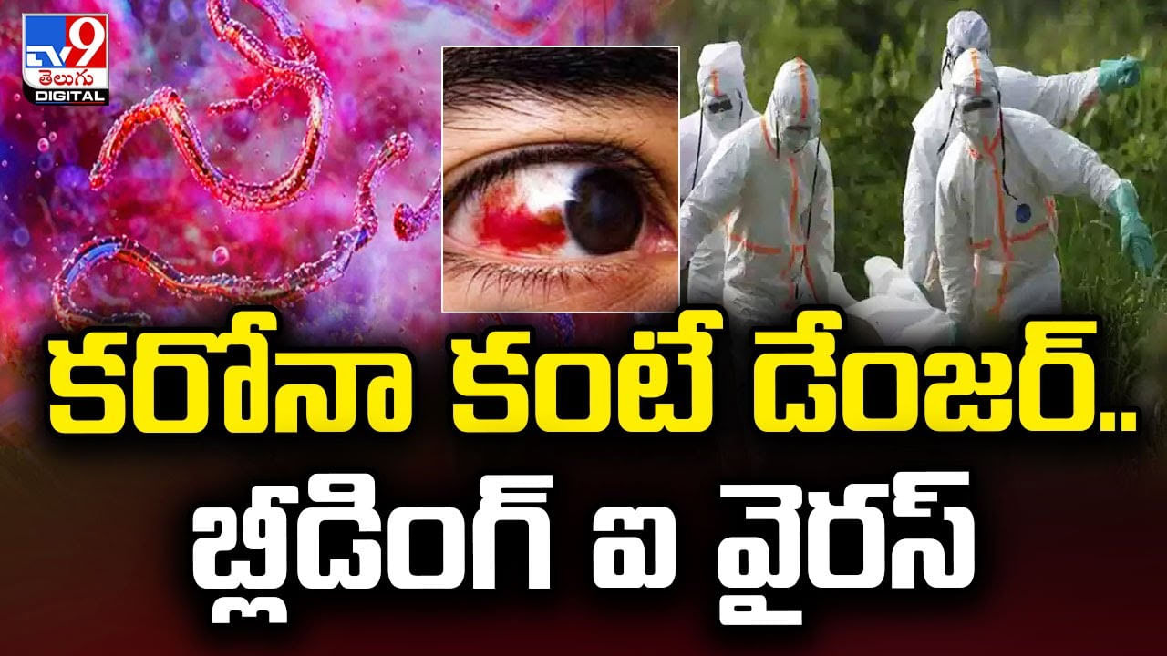 Bleeding Eye: కరోనా కంటే డేంజర్‌.. బ్లీడింగ్ ఐ వైరస్ !!