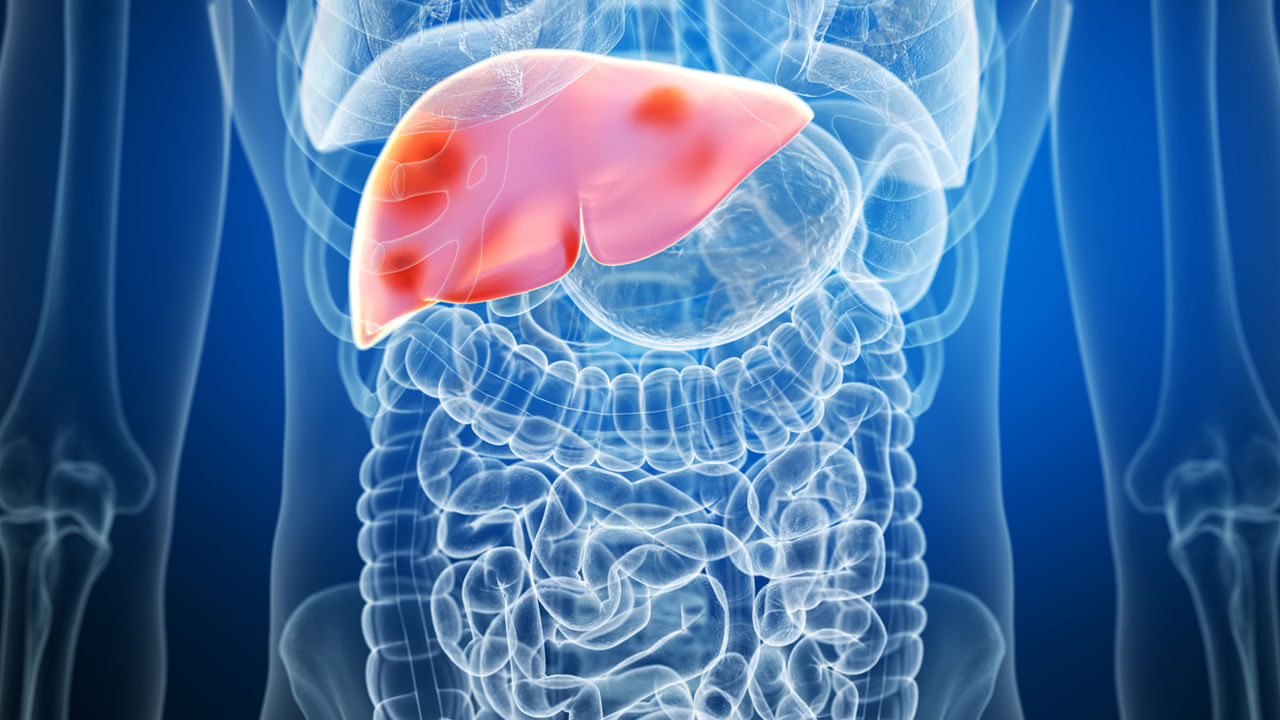 Fatty Liver: యువతలో ఫ్యాటీ లివర్ ప్రాబ్లమ్.. అశ్రద్ధ చేస్తే కష్టమే!