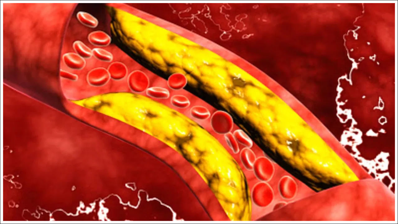 Cholesterol: శరీరంలో కొలెస్ట్రాల్ స్థాయి పాదాలను చూస్తే అర్థమవుతుంది.. ఎలాగో తెలుసా?