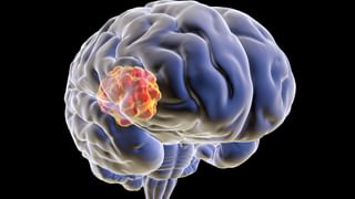 Dry Fruits: చలికాలంలో 5 రకాల డ్రై ఫ్రూట్స్ తినడం వల్ల ఆరోగ్యంపై ఎలాంటి ప్రభావం చూపిస్తుందో తెలుసా..