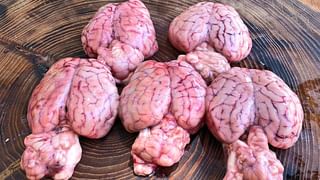 Gas Pain: గ్యాస్ వల్ల పొట్ట నొప్పి వస్తుందా.. ఈ టిప్స్‌తో పరార్!