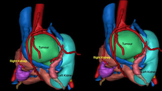 Hyderabad: అల్లు అర్జున్ ఇంటి వద్ద తీవ్ర ఉద్రిక్తత..